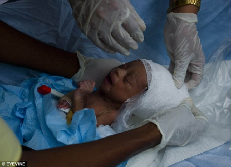 海地災(zāi)區(qū)上演生命奇跡 約3周大女嬰成功獲救